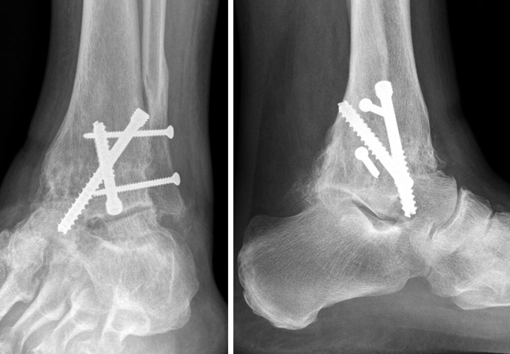 Pathologies & Traitements Centre du pied — free download